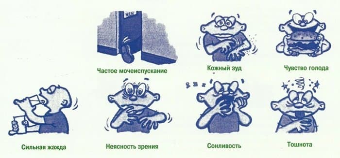 Симптомы гипергликемии.