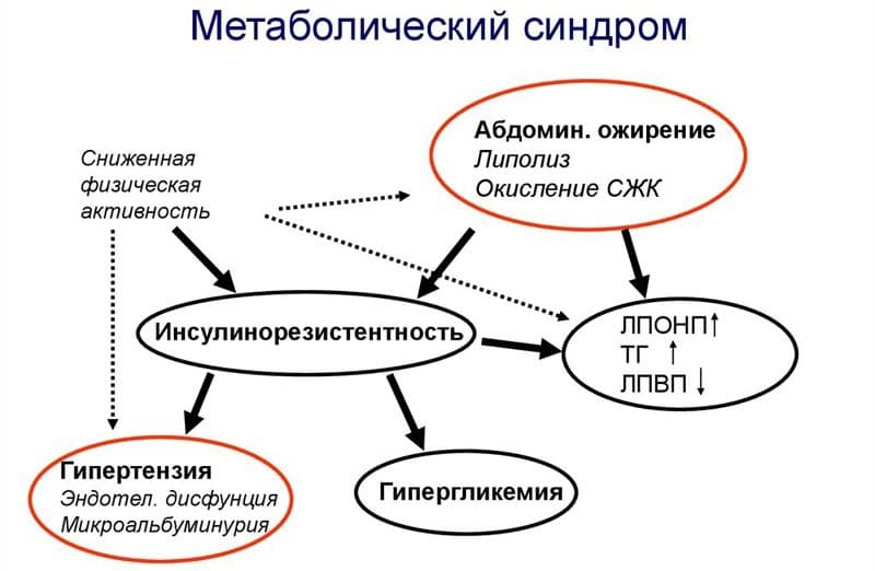 Патогенез метаболического синдрома.