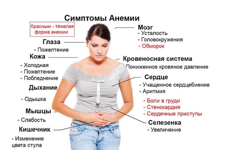 Симптомы анемии.