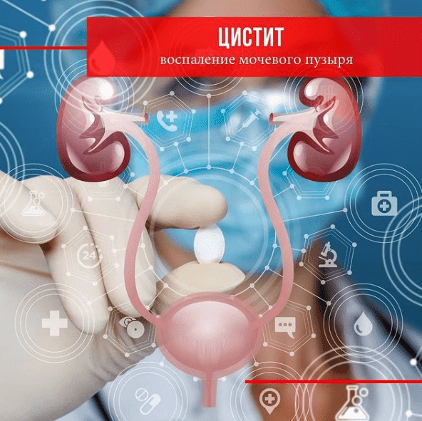 При цистите нутриент воздействует на зону воспаления.