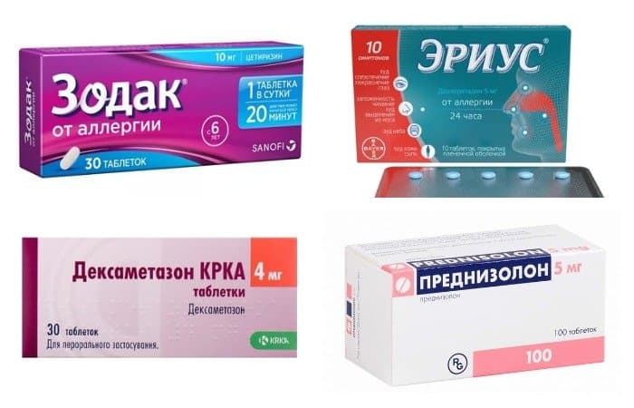 При лечении аллергии обязательно используем лекарственные препараты.