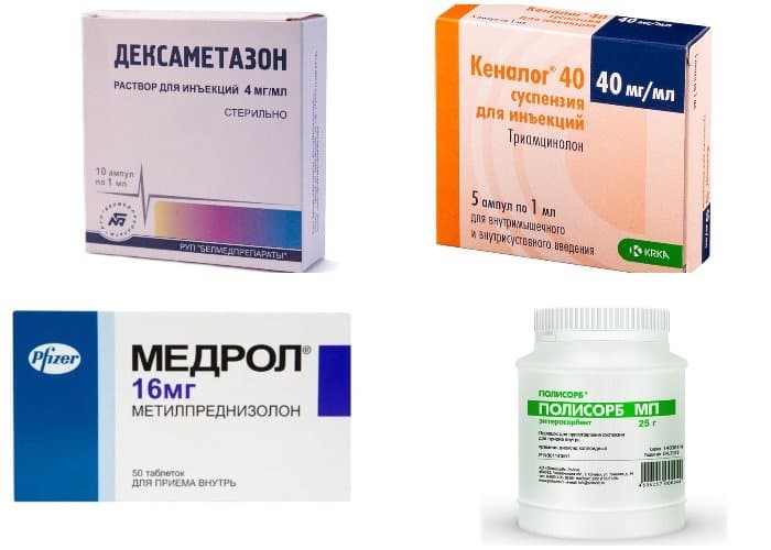 Медикаментозное лечение аллергии.