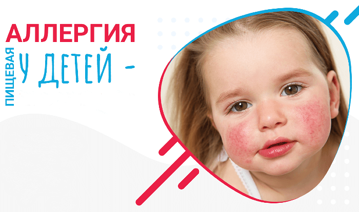 Аллергия у детей может быть следствием генетической предрасположенности.