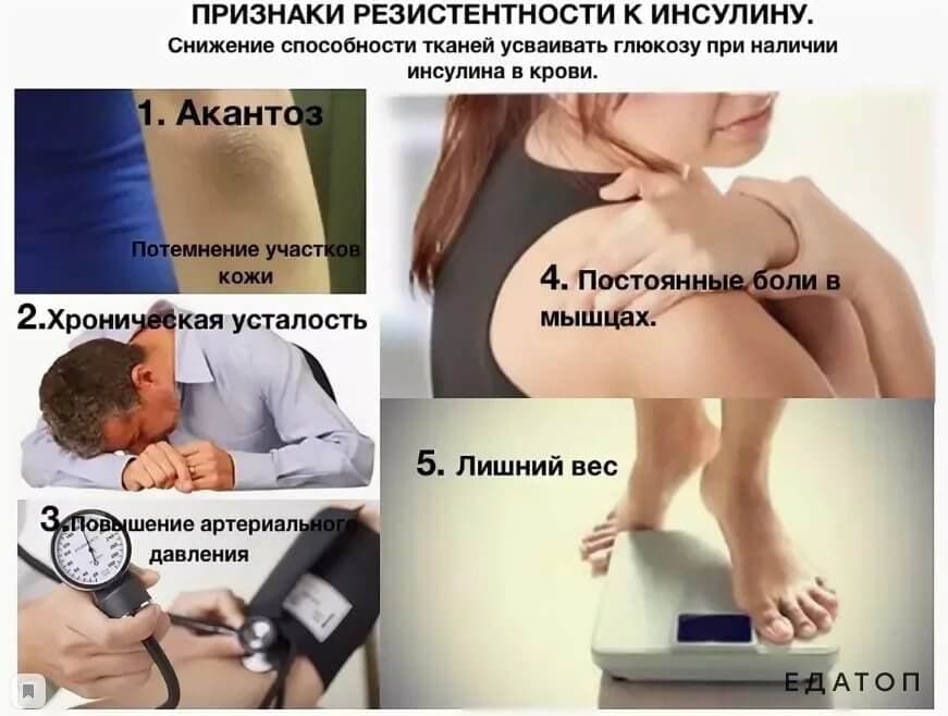 Инсулинорезистентность имеет ряд характерных симптомов.