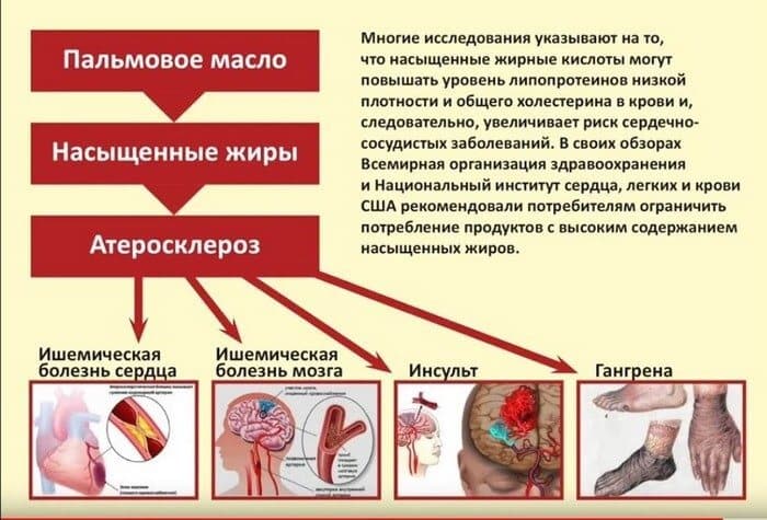 Пальмовое масло может стать причиной развития множества опасных заболеваний.
